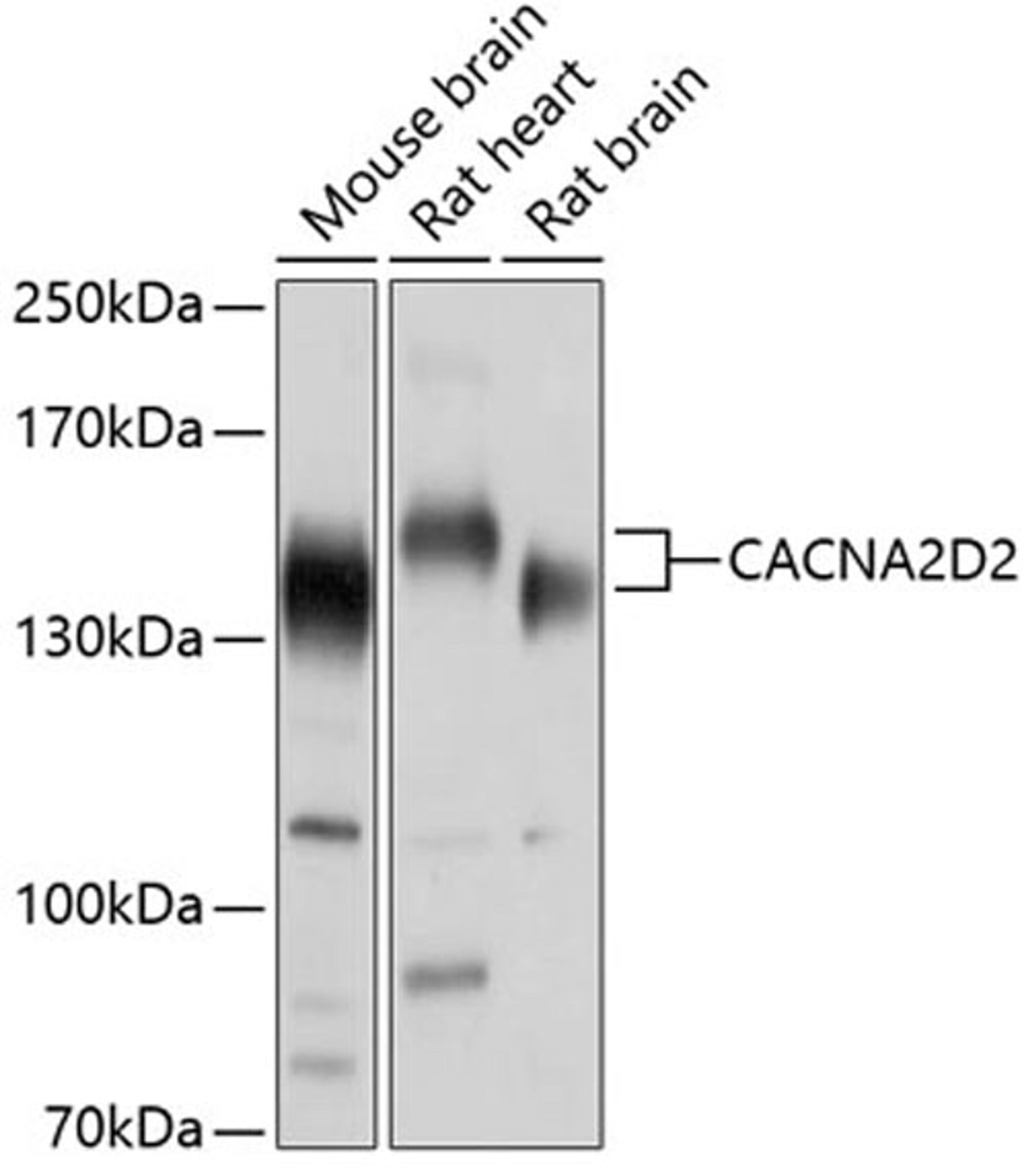 Western blot - CACNA2D2 antibody (A10267)