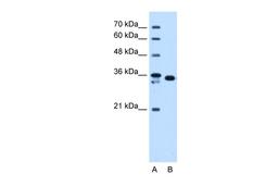 Antibody used in WB on Human HepG2 at 1.25 ug/ml.