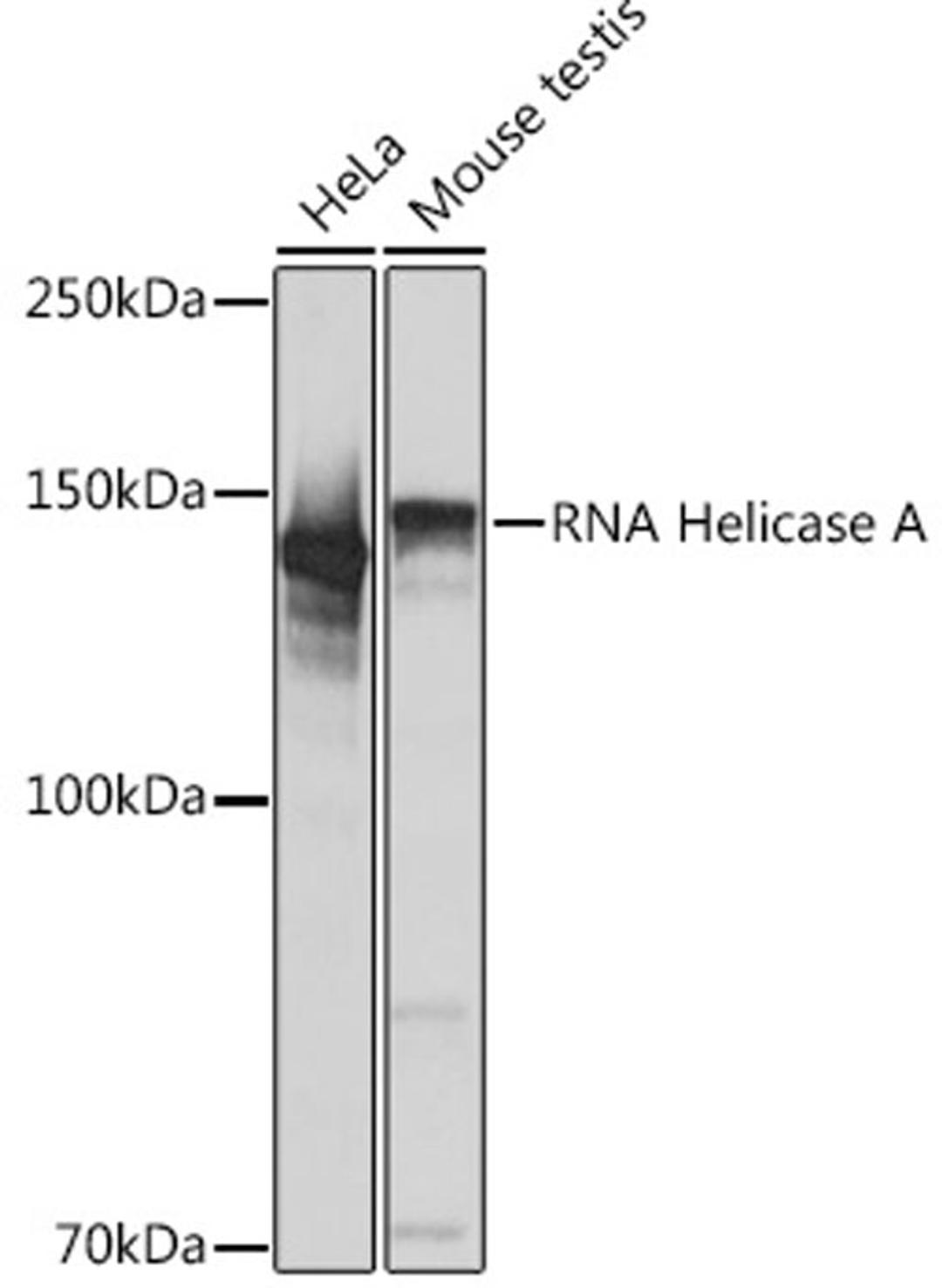 Western blot - RNA Helicase A Rabbit mAb (A4563)