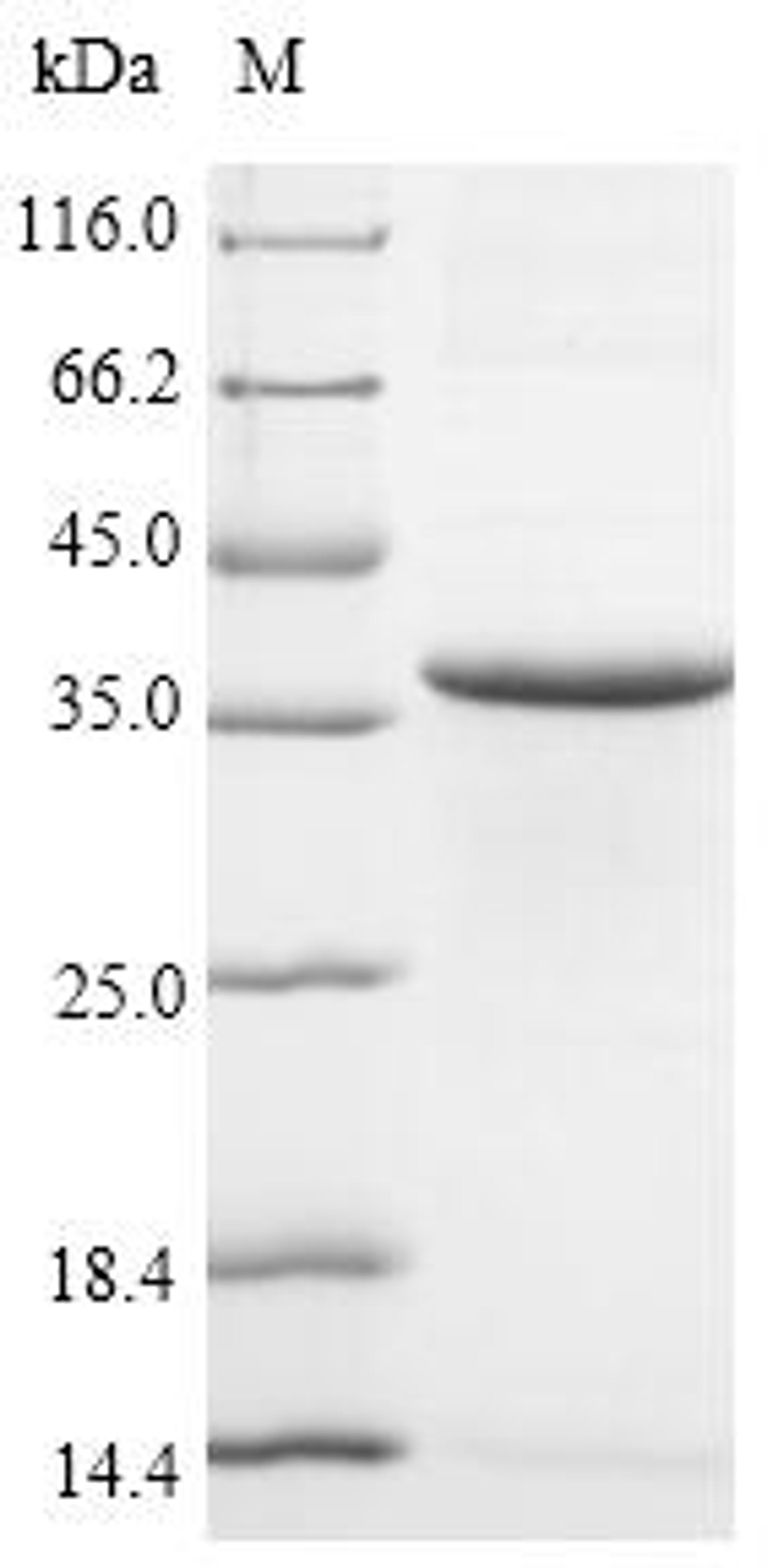 (Tris-Glycine gel) Discontinuous SDS-PAGE (reduced) with 5% enrichment gel and 15% separation gel.