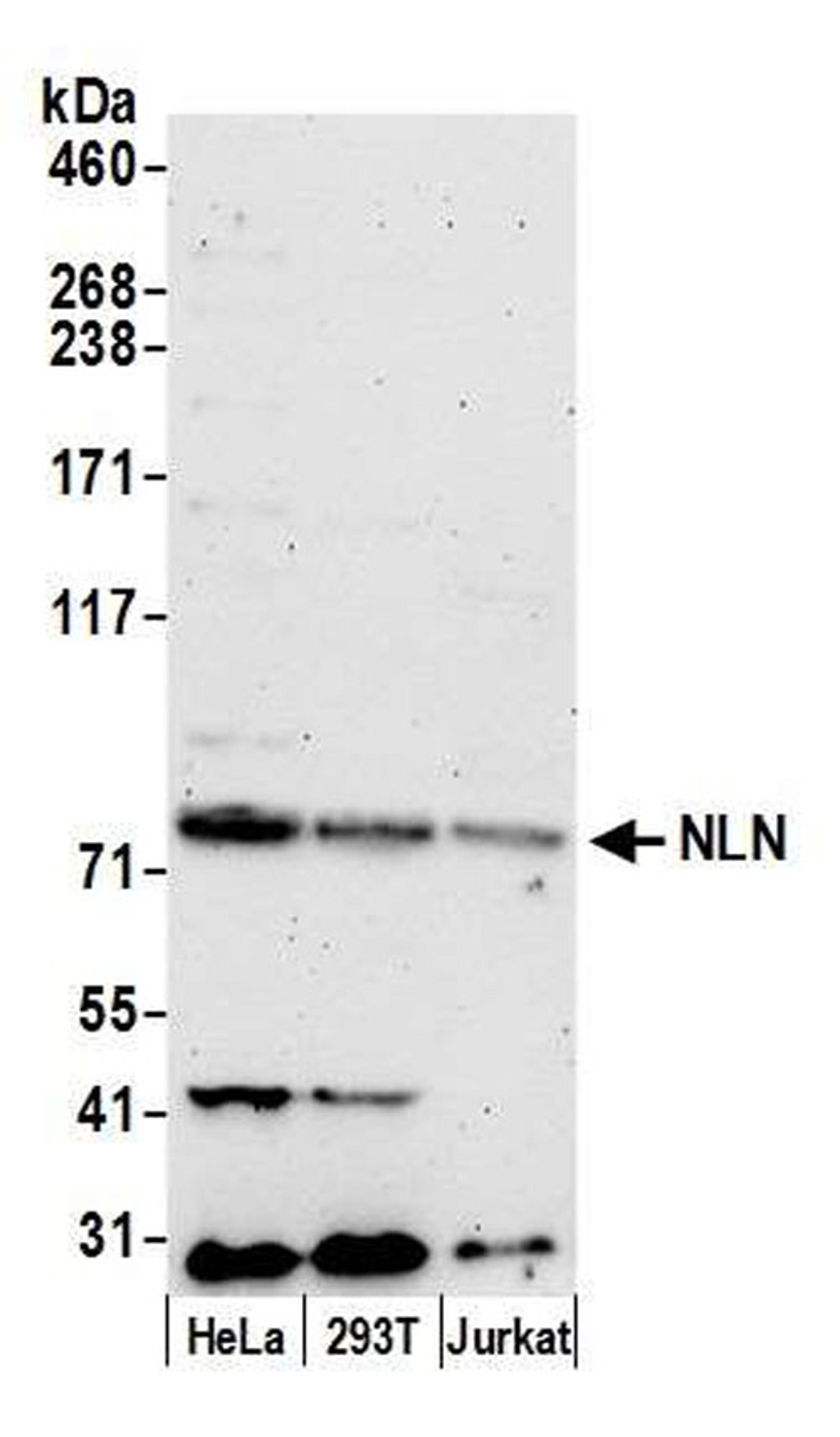 Detection of human NLN by WB.