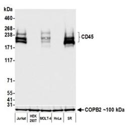 Detection of human CD45 by western blot.