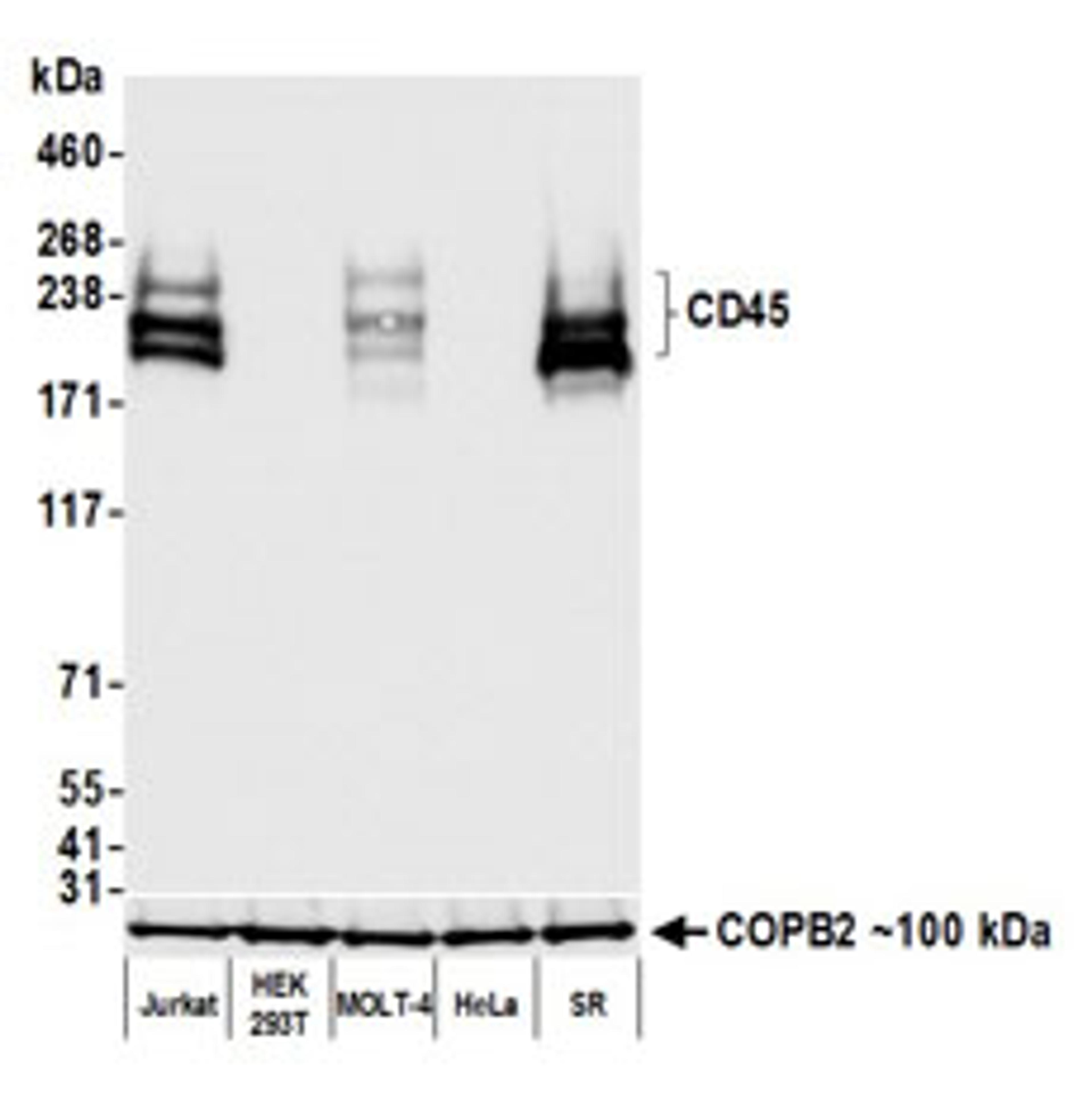 Detection of human CD45 by western blot.