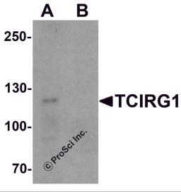 Western blot analysis of TCIRG1 in EL4 cell lysate with TCIRG1 antibody at 0.5 &#956;g/ml in (A) the absence and (B) the presence of blocking peptide.