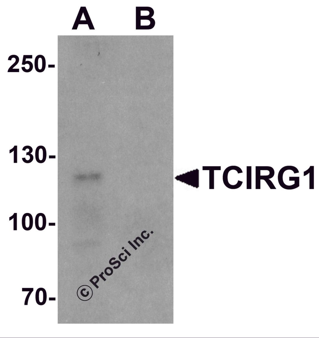 Western blot analysis of TCIRG1 in EL4 cell lysate with TCIRG1 antibody at 0.5 μg/ml in (A) the absence and (B) the presence of blocking peptide.
