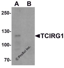 Western blot analysis of TCIRG1 in EL4 cell lysate with TCIRG1 antibody at 0.5 μg/ml in (A) the absence and (B) the presence of blocking peptide.