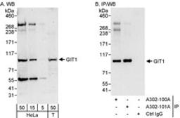 Detection of human GIT1 by western blot and immunoprecipitation.