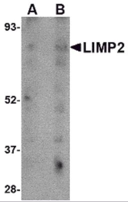 Western blot analysis of LIMP2 in human skeletal muscle tissue lysate with LIMP2 antibody at (A) 1 and (B) 2 &#956;g/mL.