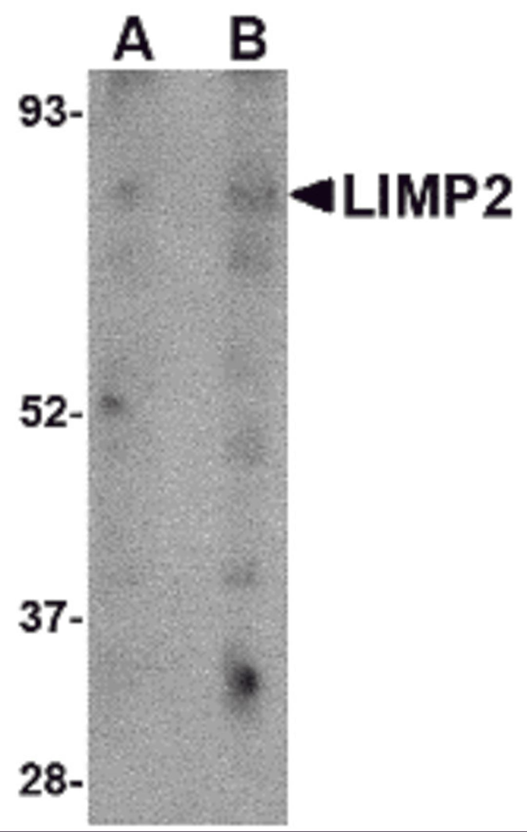 Western blot analysis of LIMP2 in human skeletal muscle tissue lysate with LIMP2 antibody at (A) 1 and (B) 2 μg/mL.