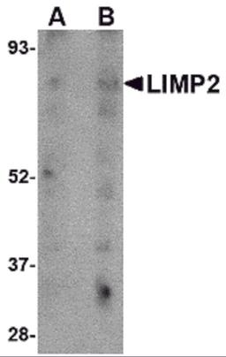 Western blot analysis of LIMP2 in human skeletal muscle tissue lysate with LIMP2 antibody at (A) 1 and (B) 2 μg/mL.
