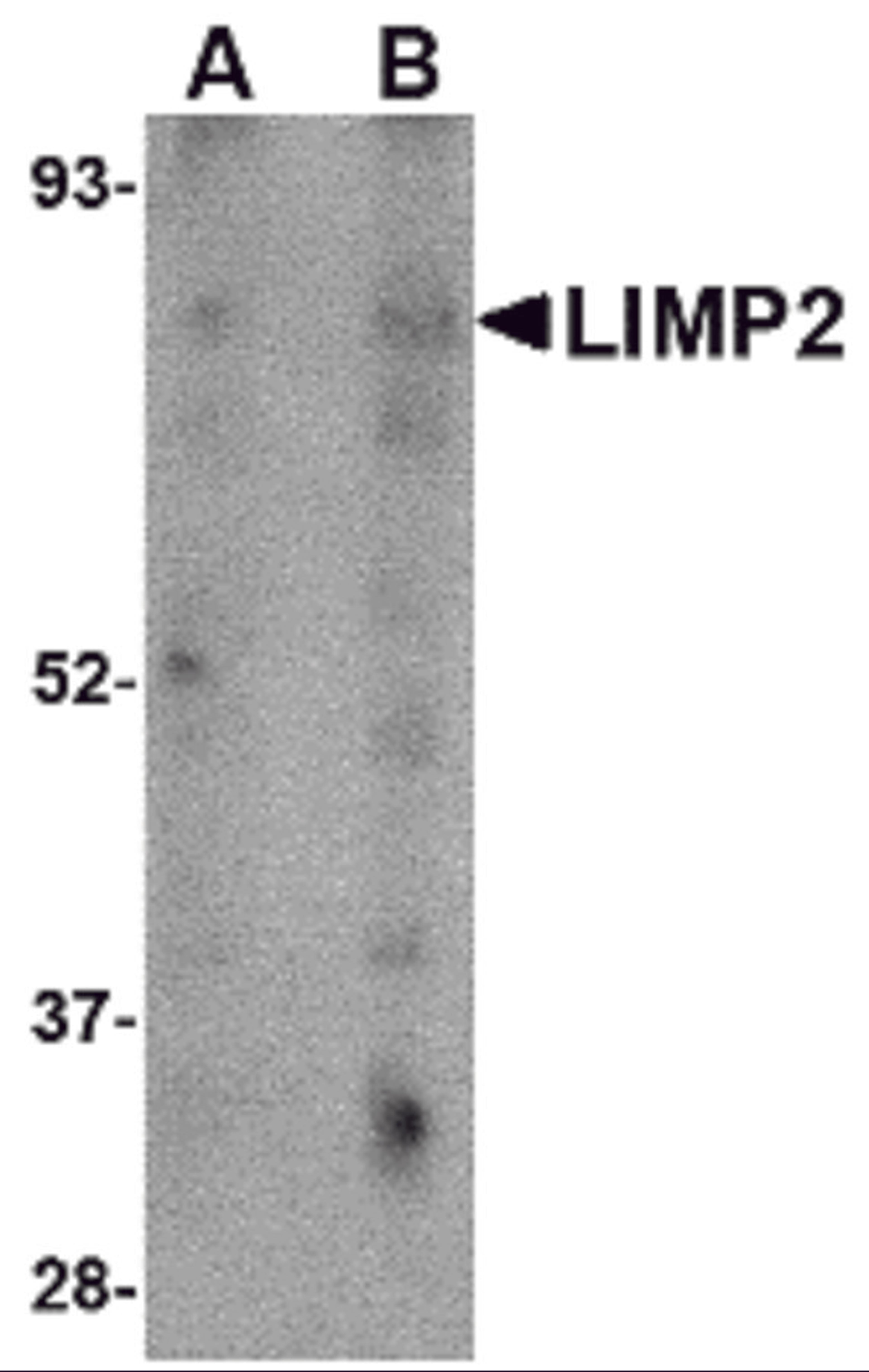 Western blot analysis of LIMP2 in human skeletal muscle tissue lysate with LIMP2 antibody at (A) 1 and (B) 2 μg/mL.