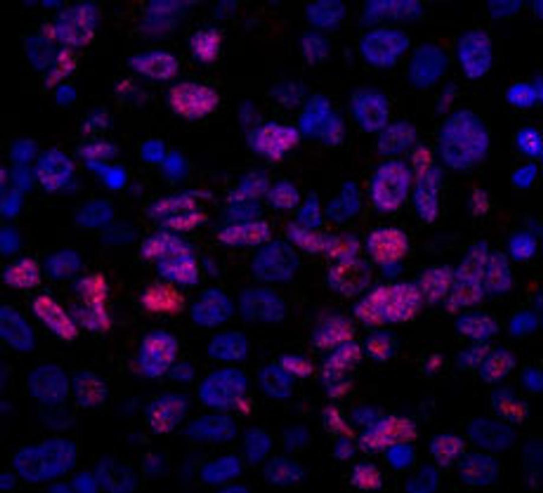 Detection of human NCOA5/CIA by immunohistochemistry.