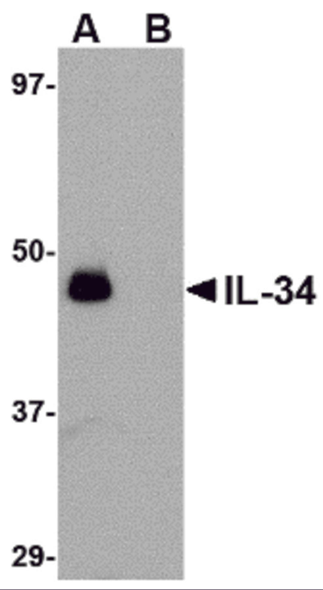 Western blot analysis of IL-34 in human brain tissue lysate with IL-34 antibody at 0.25 μg/mL in (A) the absence and (B) the presence of blocking peptide.