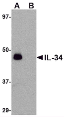 Western blot analysis of IL-34 in human brain tissue lysate with IL-34 antibody at 0.25 μg/mL in (A) the absence and (B) the presence of blocking peptide.
