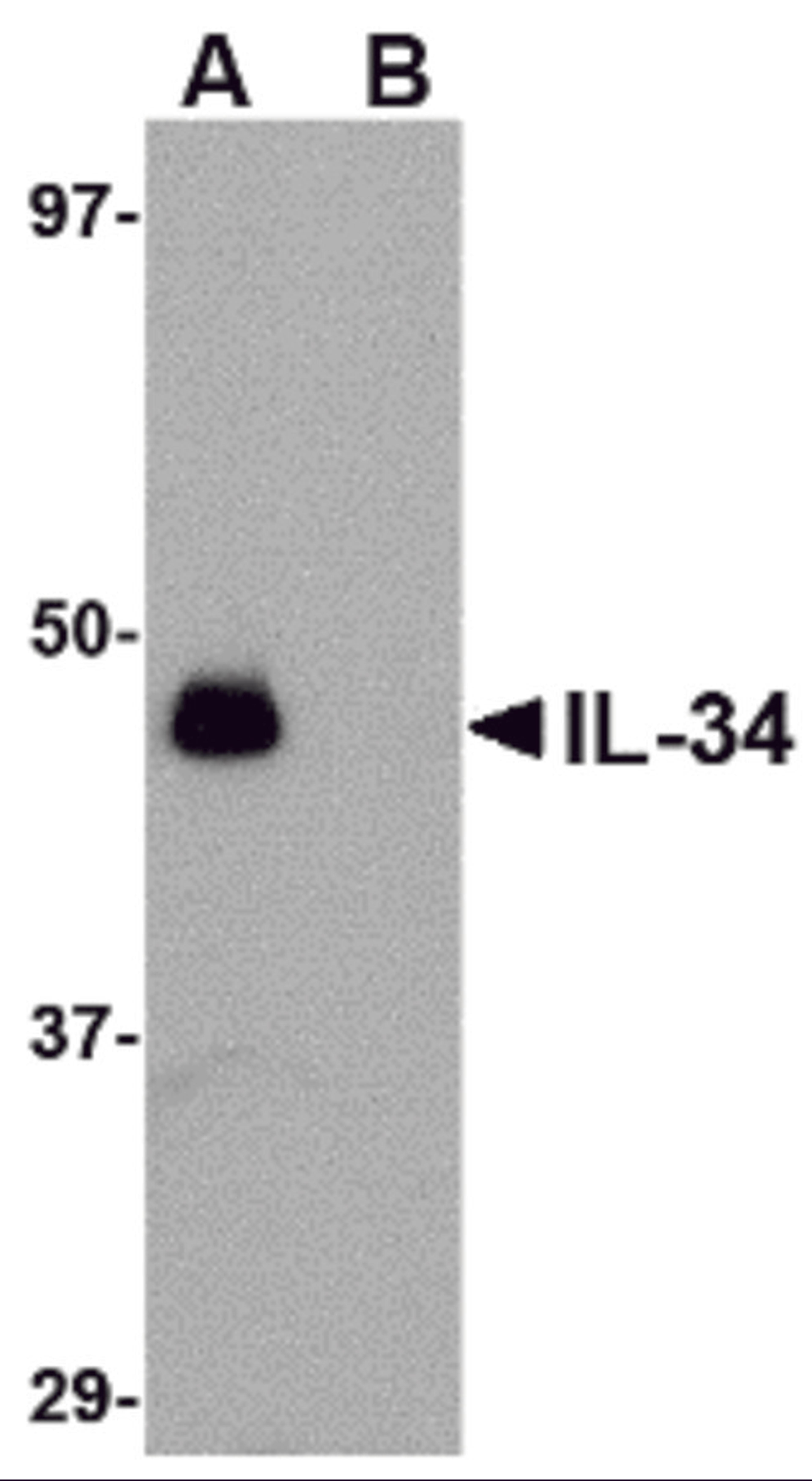Western blot analysis of IL-34 in human brain tissue lysate with IL-34 antibody at 0.25 μg/mL in (A) the absence and (B) the presence of blocking peptide.