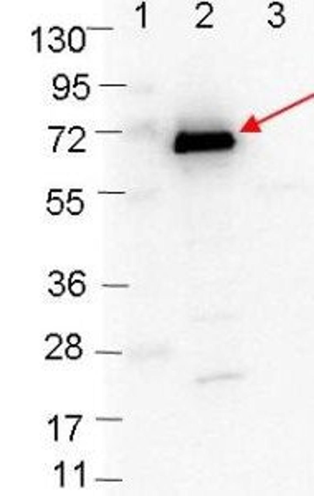 Western blot analysis of Lane 1: Molecular weight markers. Lane 2: MBP-OspC fusion protein (arrow; expected MW: 63.1 kDa). Lane 3: MBP alone using OspC antibody