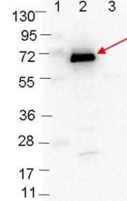 Western blot analysis of Lane 1: Molecular weight markers. Lane 2: MBP-OspC fusion protein (arrow; expected MW: 63.1 kDa). Lane 3: MBP alone using OspC antibody