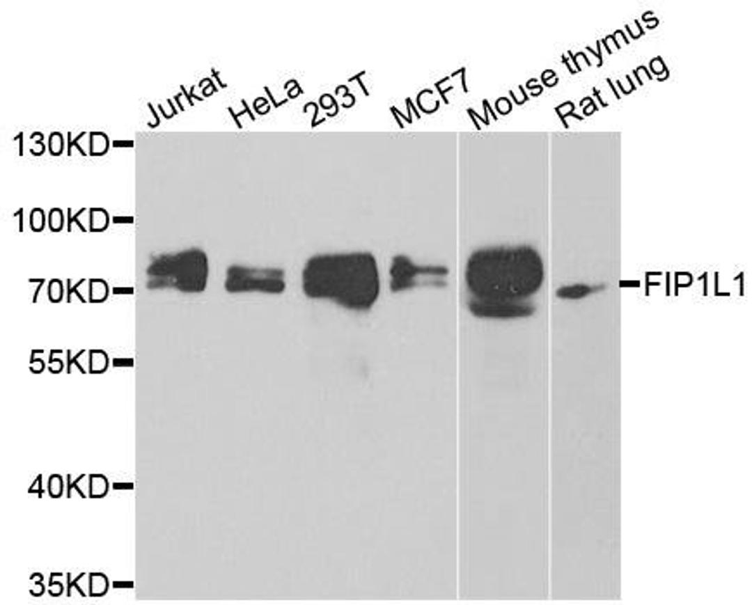 Western blot analysis of extracts of various cell lines using FIP1L1 antibody