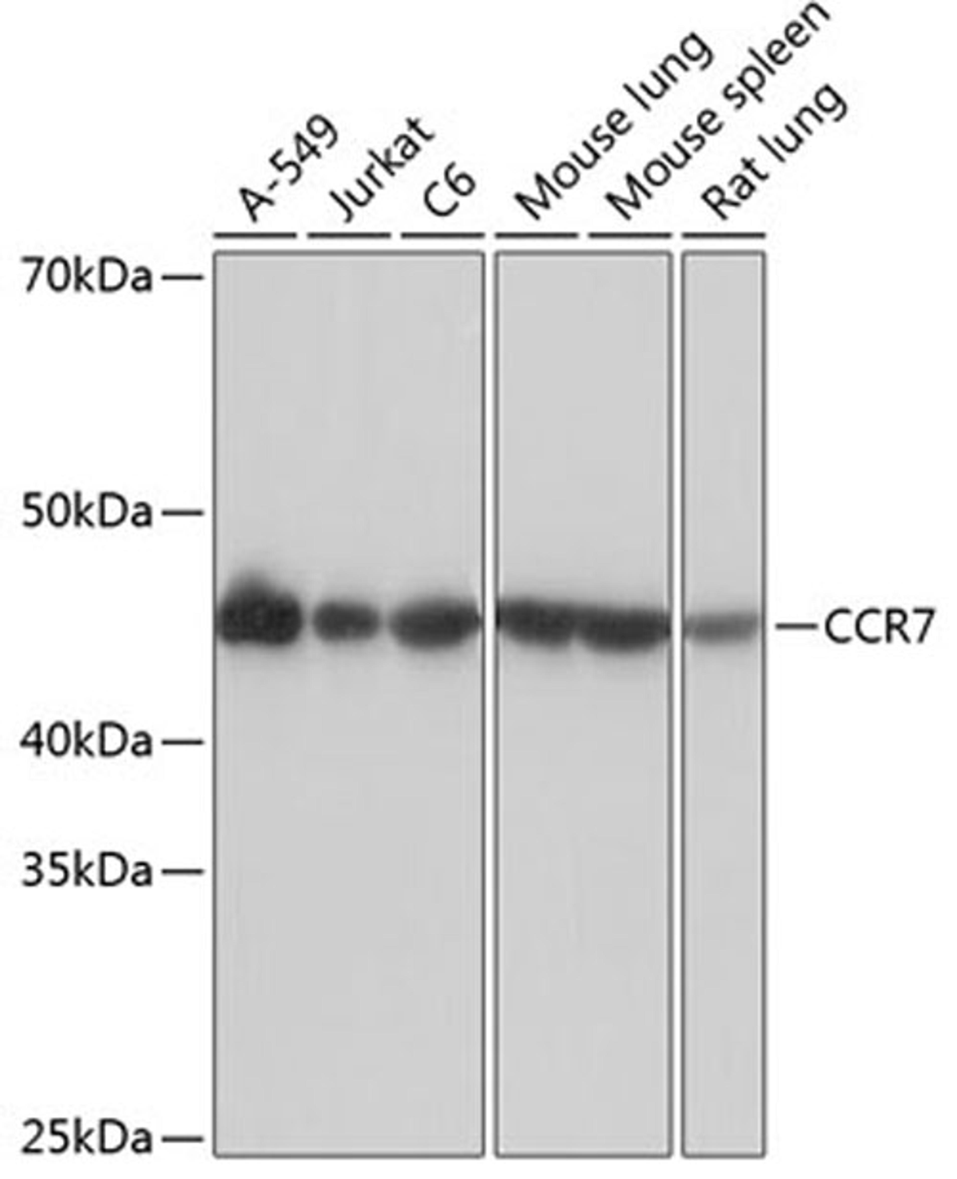 Western blot - CCR7 Rabbit mAb (A0121)