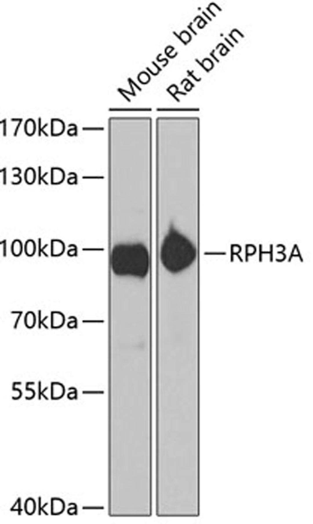 Western blot - RPH3A antibody (A6722)