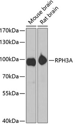 Western blot - RPH3A antibody (A6722)