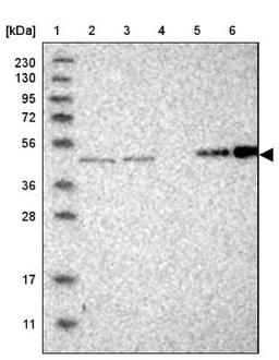 Western Blot: SMAP2 Antibody [NBP1-80737] - Lane 1: Marker [kDa] 230, 130, 95, 72, 56, 36, 28, 17, 11<br/>Lane 2: Human cell line RT-4<br/>Lane 3: Human cell line U-251MG sp<br/>Lane 4: Human plasma (IgG/HSA depleted)<br/>Lane 5: Human liver tissue<br/>Lane 6: Human tonsil tissue