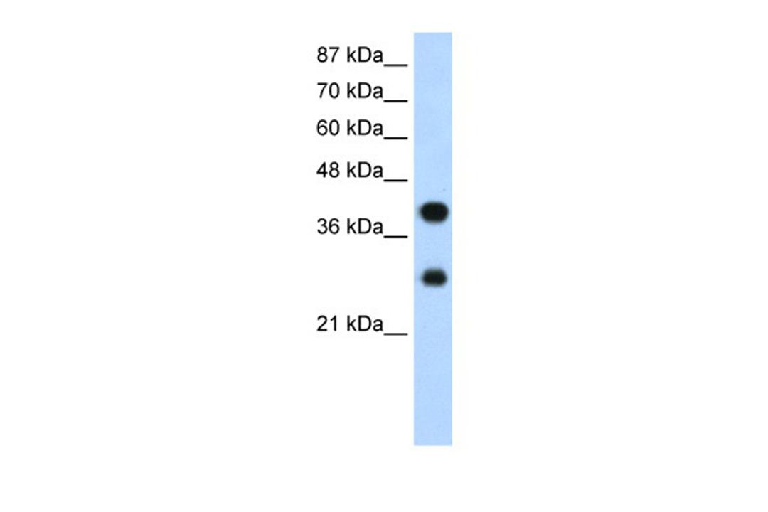 Antibody used in WB on Human Jurkat 1.25 ug/ml.