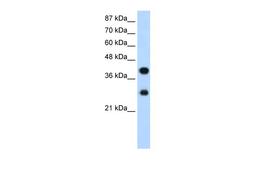 Antibody used in WB on Human Jurkat 1.25 ug/ml.