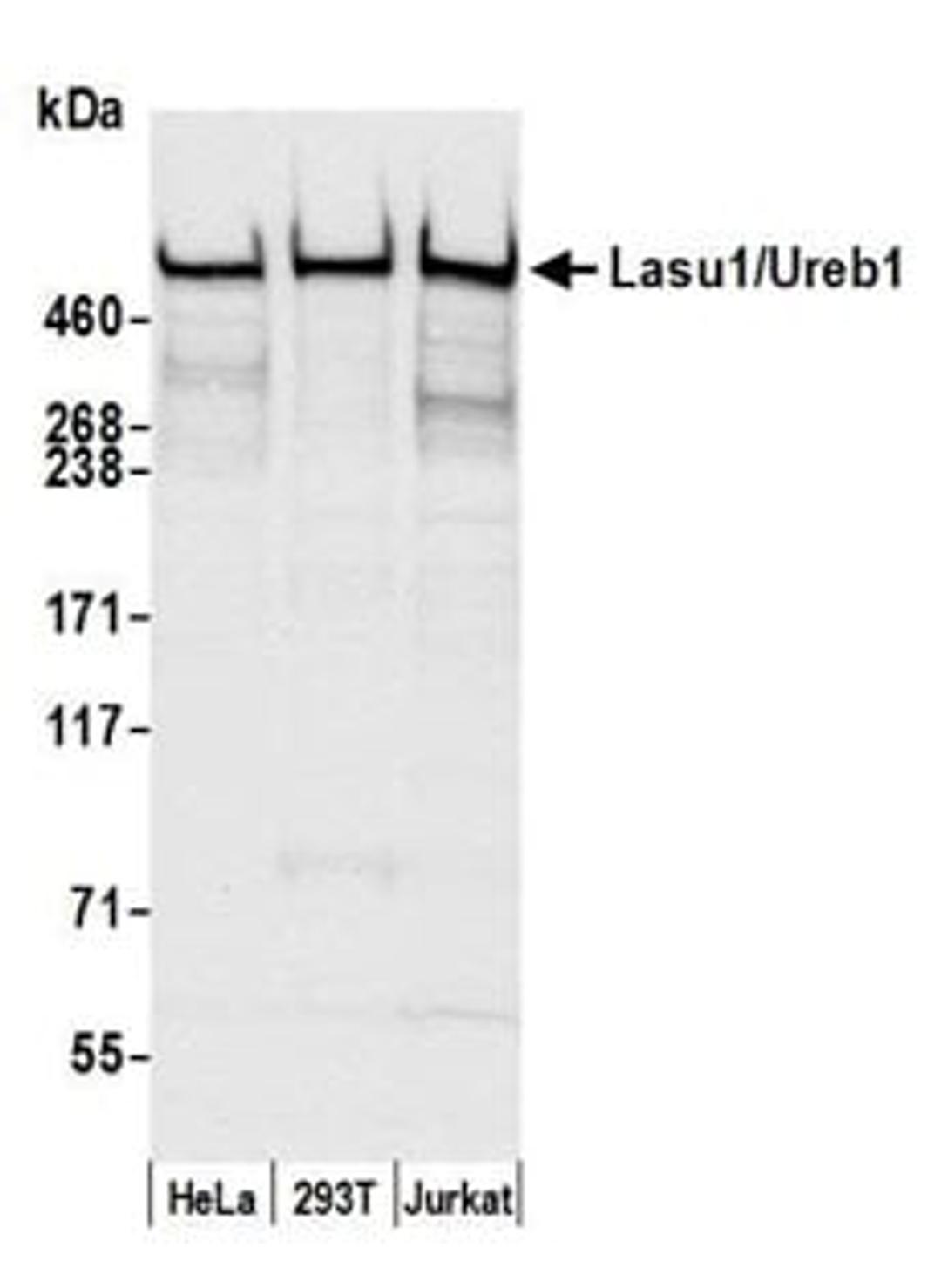 Detection of human Lasu1/Ureb1 by western blot.