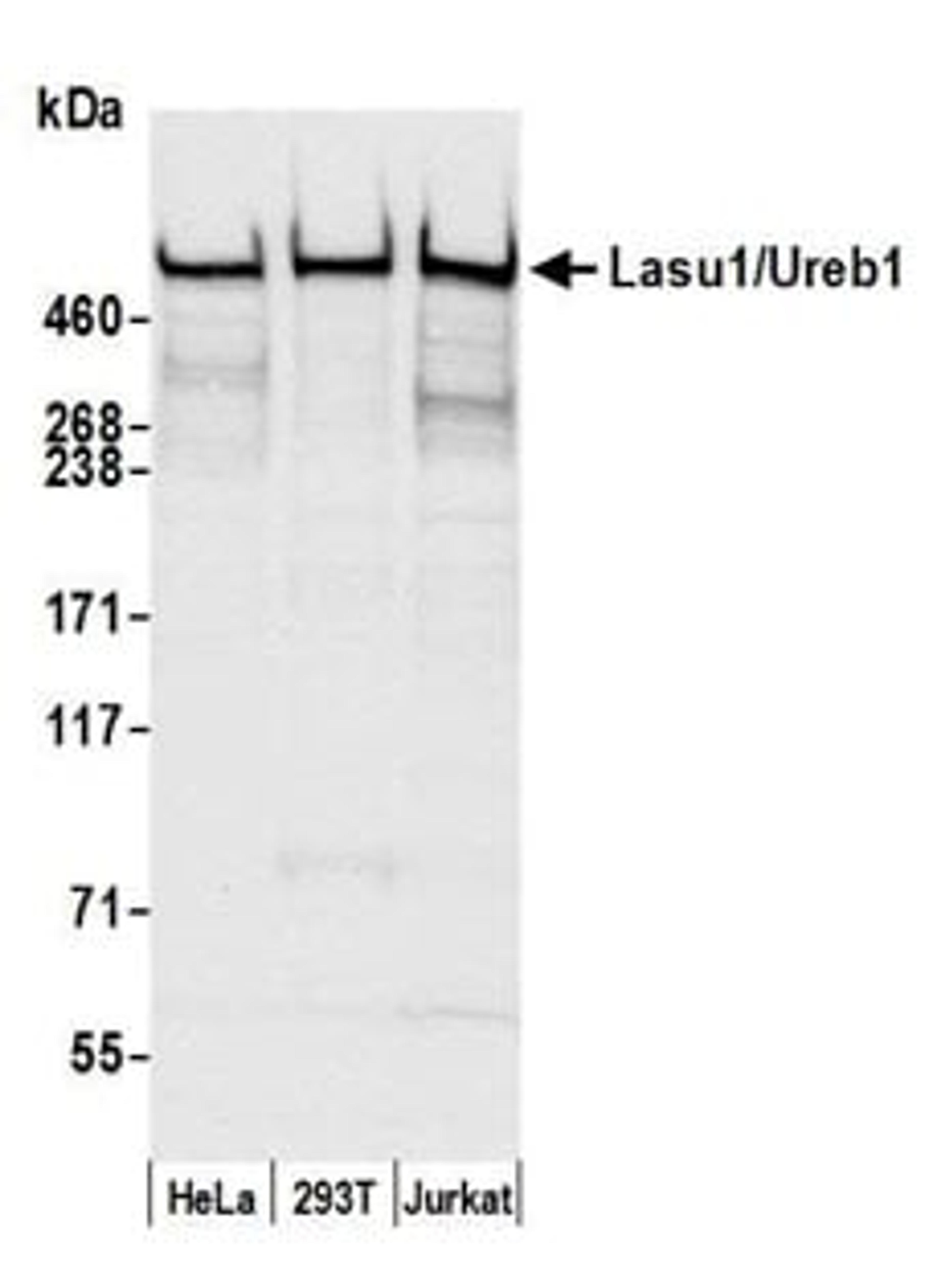 Detection of human Lasu1/Ureb1 by western blot.