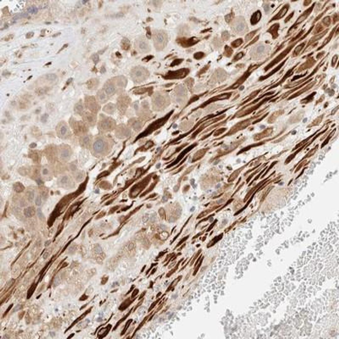 Immunohistochemistry: FAT1 Antibody [NBP1-84565] - Staining of human placenta shows strong cytoplasmic positivity in Decidual cells.