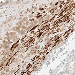 Immunohistochemistry: FAT1 Antibody [NBP1-84565] - Staining of human placenta shows strong cytoplasmic positivity in Decidual cells.