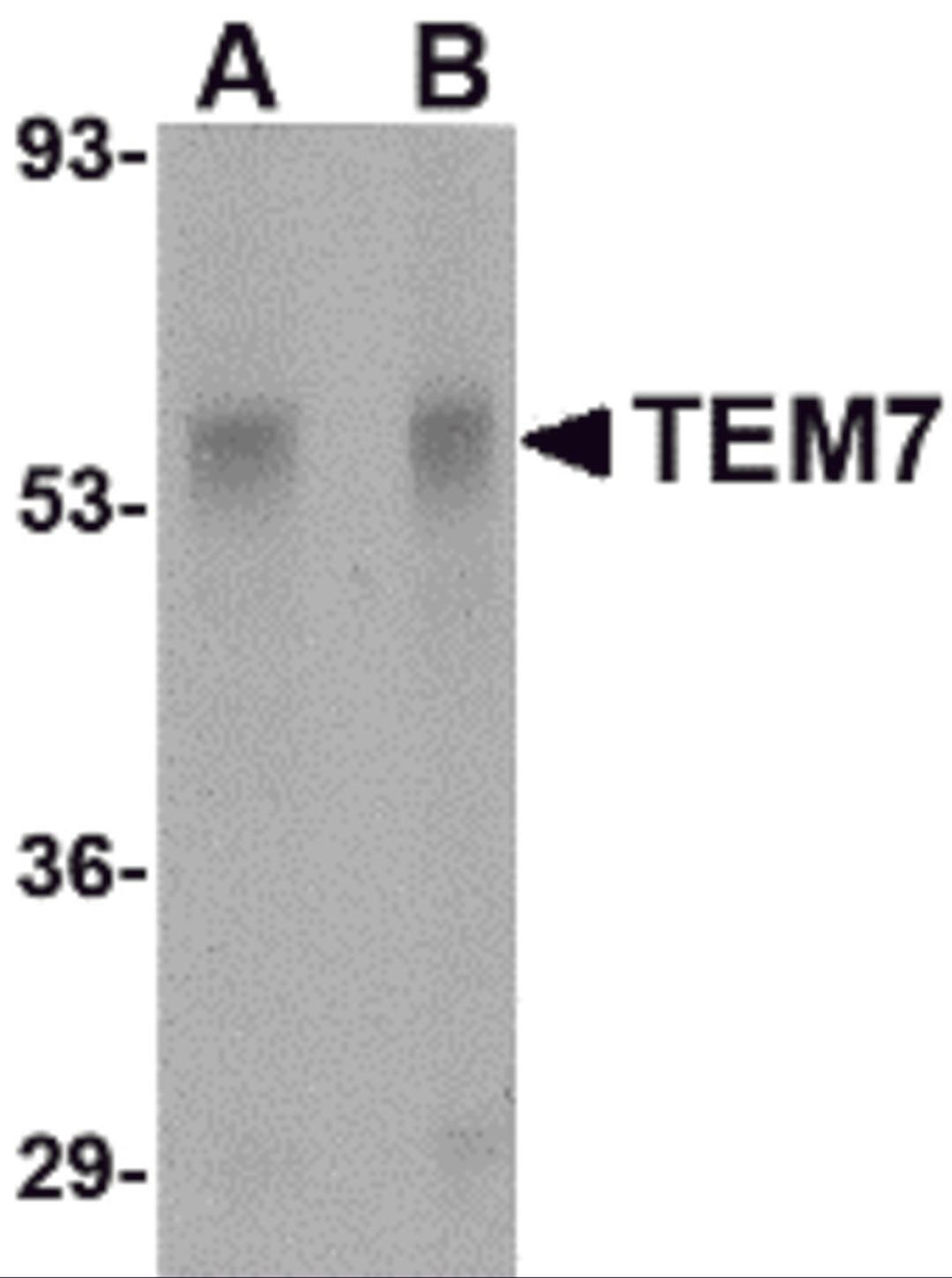 Western blot analysis of TEM7 in rat liver tissue lysate with TEM7 antibody at (A) 0.5 and (B) 1 μg/mL.