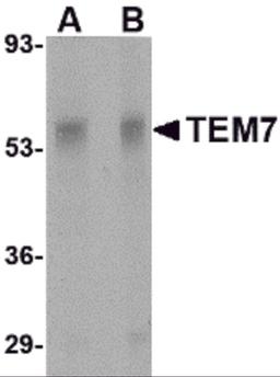 Western blot analysis of TEM7 in rat liver tissue lysate with TEM7 antibody at (A) 0.5 and (B) 1 μg/mL.