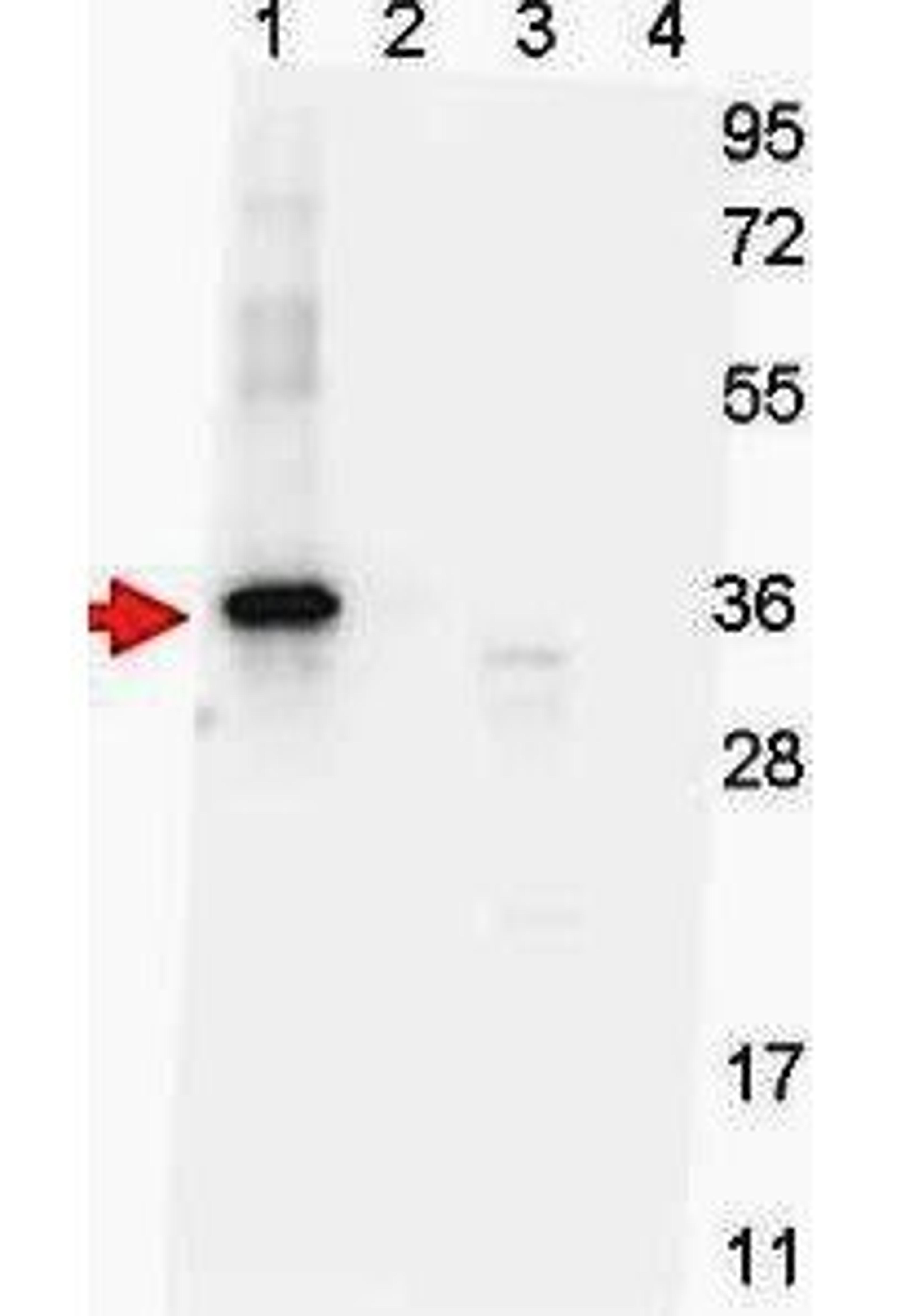 Western blot analysis of lane 2 - yeast cell lysate expressing NAG-1 D variant with SUMO expression tag at 36 kDa; lane 3 - yeast cell lysate expressing NAG-1 H variant; and lane 4 - yeast cell lysate expressing NAG-1 D variant using NAG-1 H Variant antib