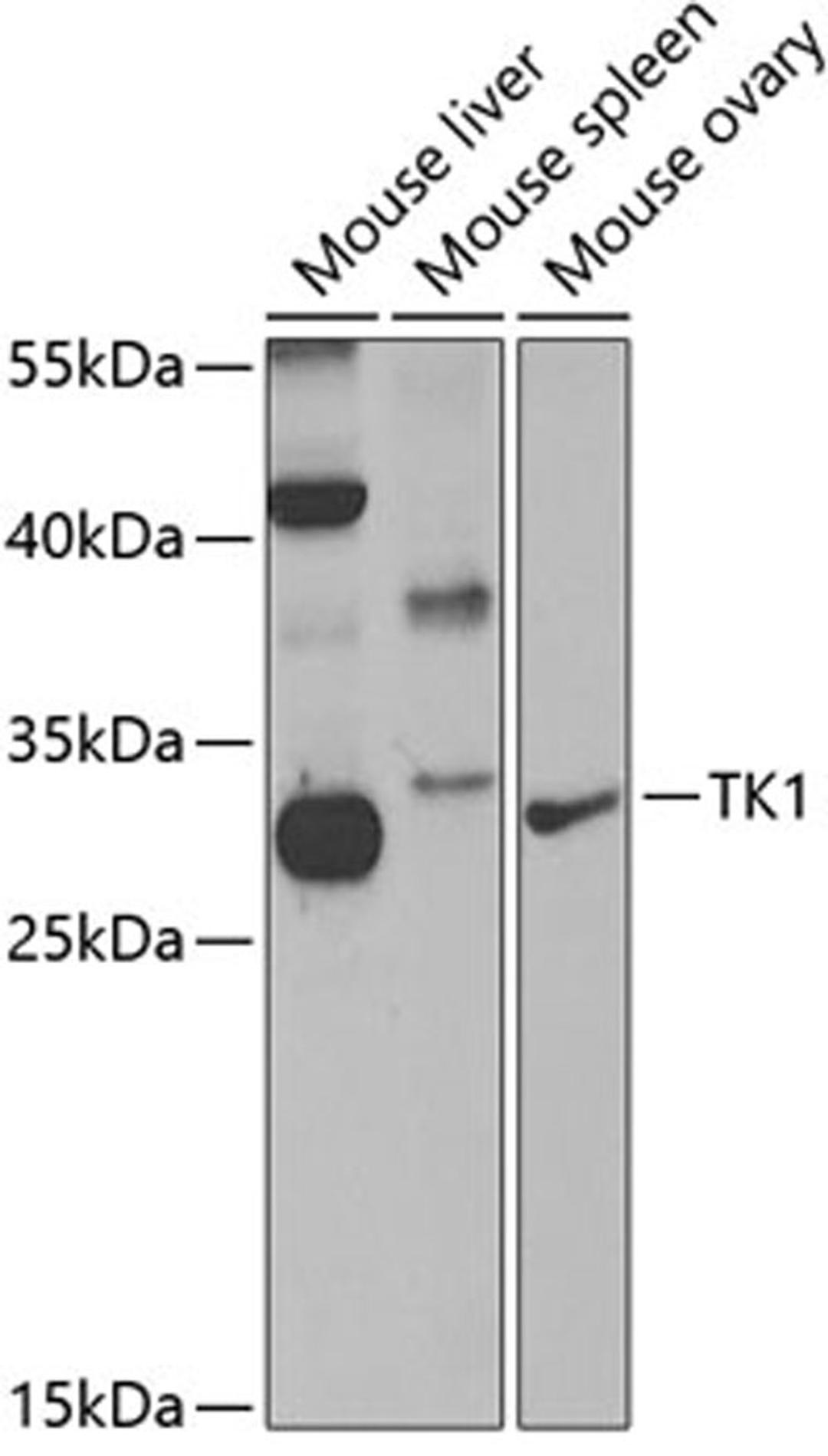 Western blot - TK1 antibody (A5612)