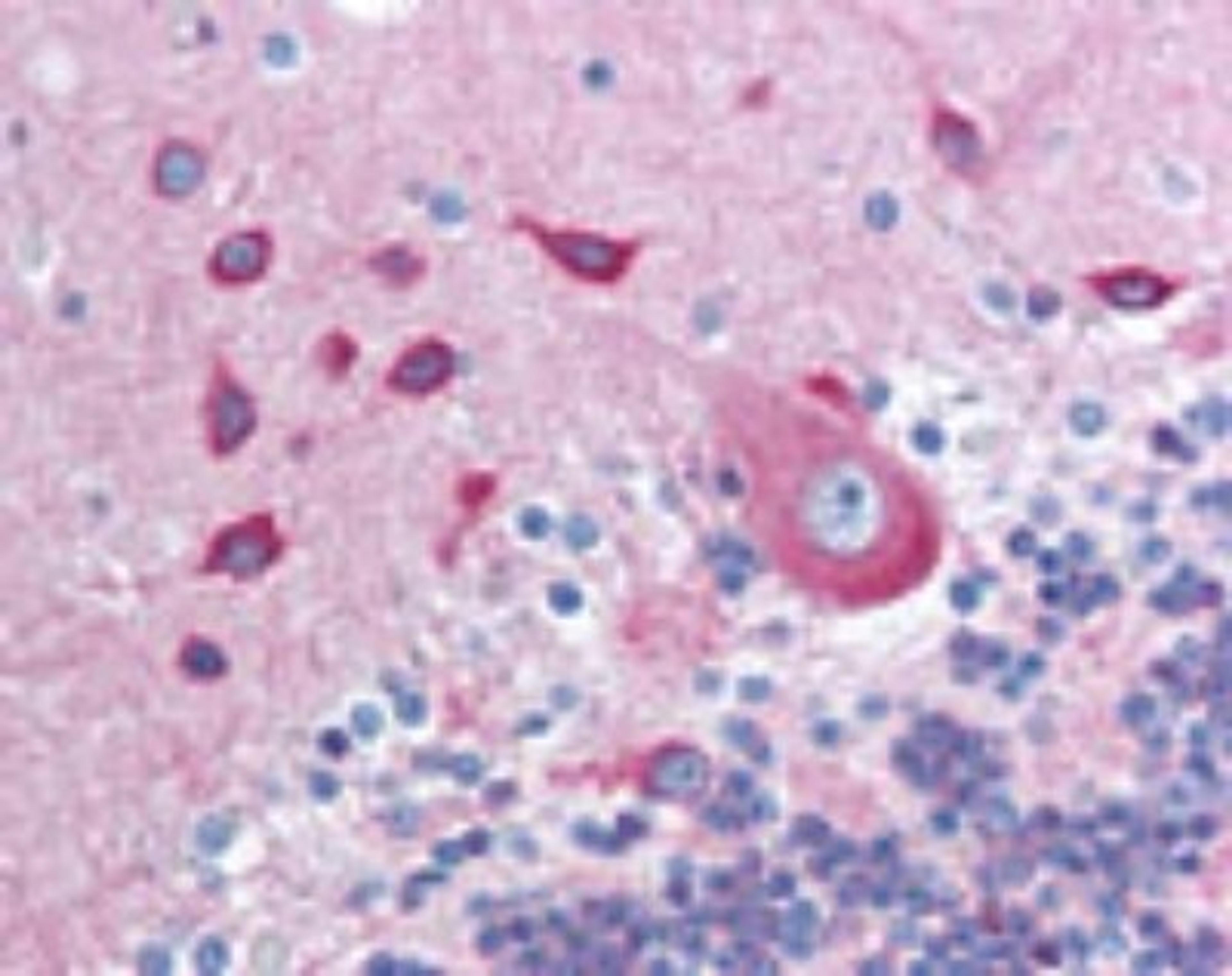 Immunohistochemistry-Paraffin: PACSIN2 Antibody [NBP2-24481] - analysis of human brain, cerebellum using this antibody at 10 ug/ml.