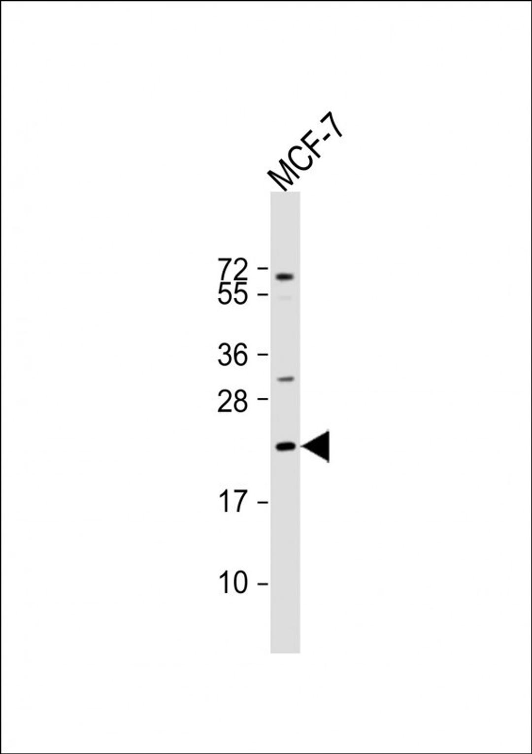 Western Blot at 1:2000 dilution + MCF-7 whole cell lysate Lysates/proteins at 20 ug per lane.