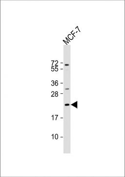 Western Blot at 1:2000 dilution + MCF-7 whole cell lysate Lysates/proteins at 20 ug per lane.