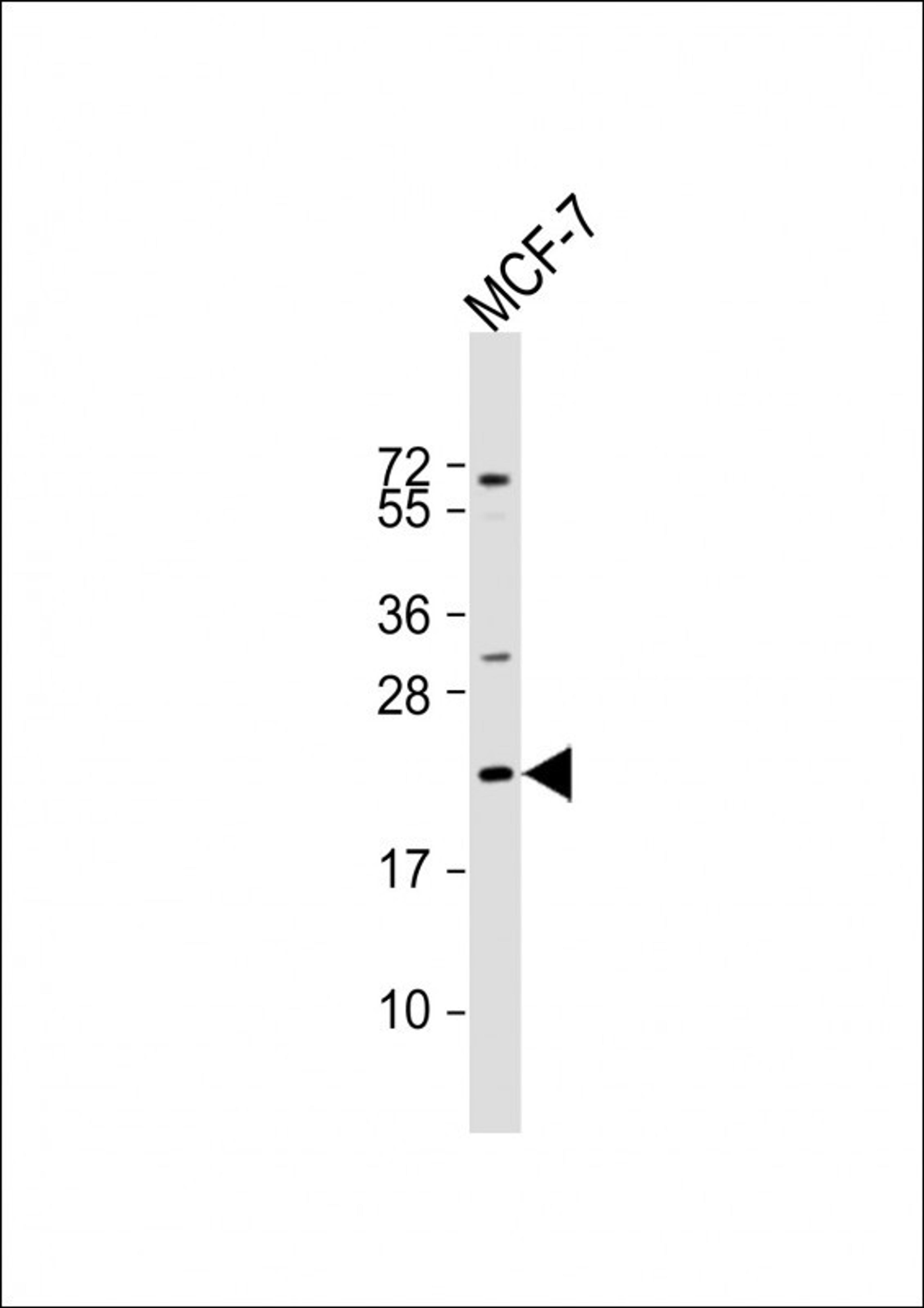 Western Blot at 1:2000 dilution + MCF-7 whole cell lysate Lysates/proteins at 20 ug per lane.