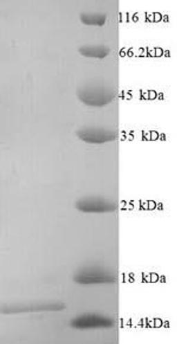 (Tris-Glycine gel) Discontinuous SDS-PAGE (reduced) with 5% enrichment gel and 15% separation gel.