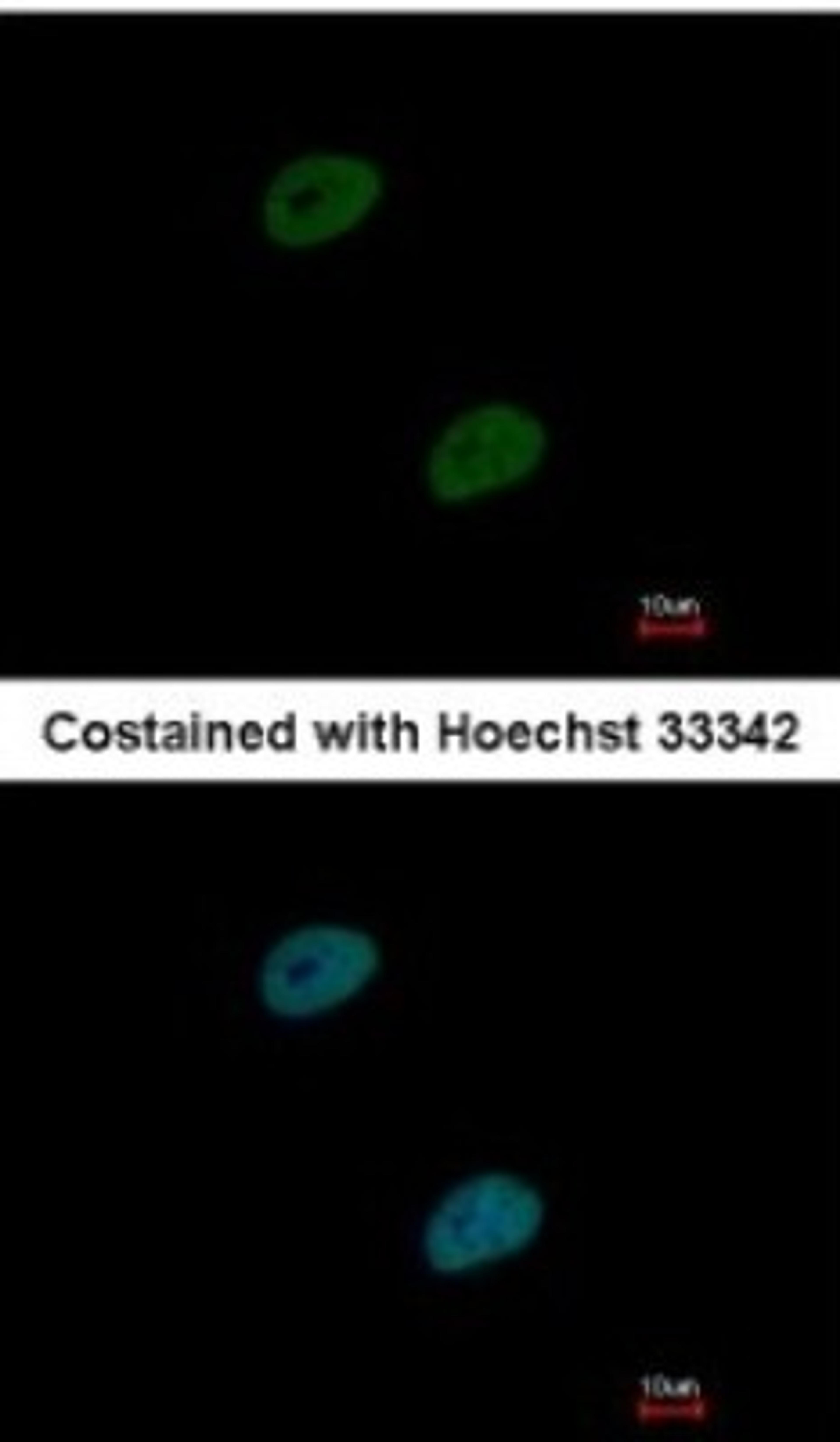 Immunocytochemistry/Immunofluorescence: TLE4 Antibody [NBP2-15140] - Paraformaldehyde-fixed HeLa, using TLE4 antibody at 1:1000 dilution.