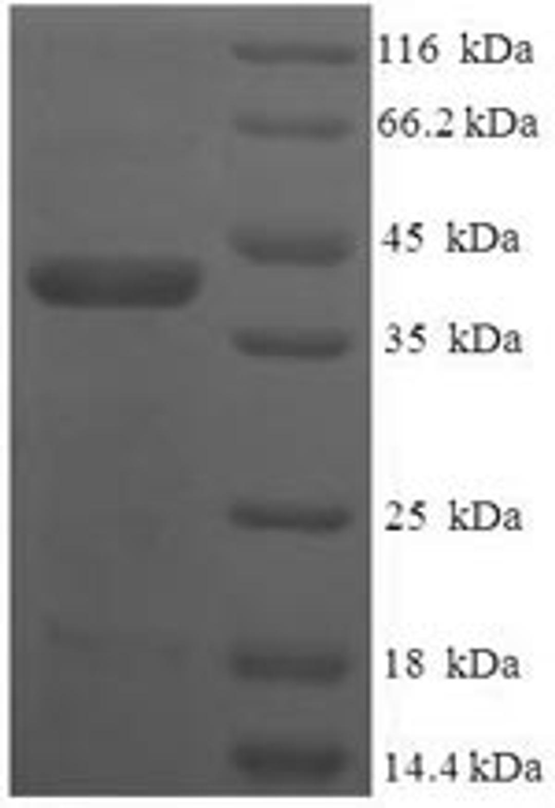 (Tris-Glycine gel) Discontinuous SDS-PAGE (reduced) with 5% enrichment gel and 15% separation gel.