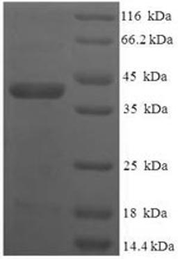 (Tris-Glycine gel) Discontinuous SDS-PAGE (reduced) with 5% enrichment gel and 15% separation gel.