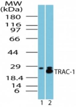 Western Blot: RNF125 Antibody [NBP2-23660] - analysis of TRAC-1 in spleen lysate. Lane 1 shows pre-immune sera and lane 2 shows this antibody.