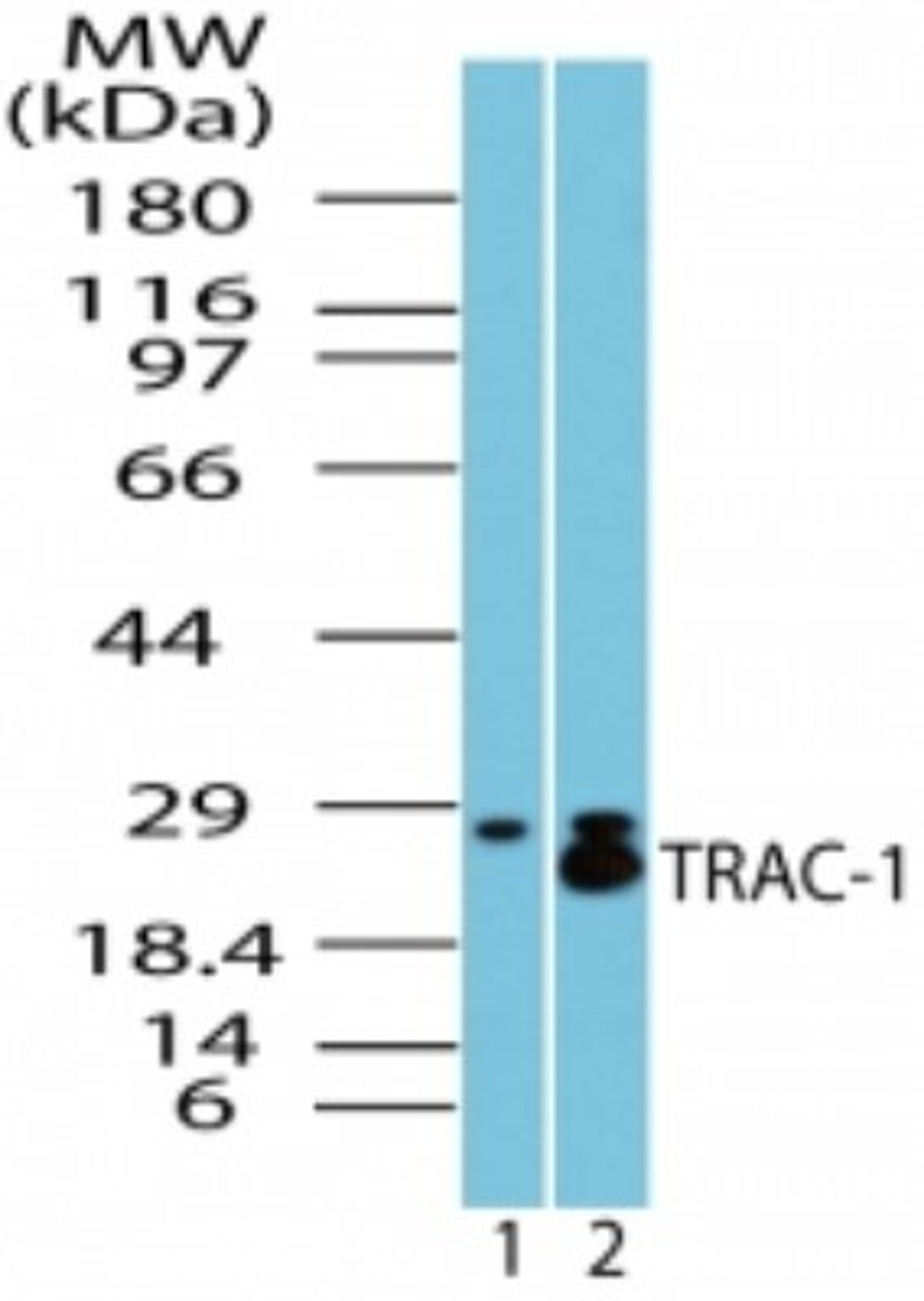 Western Blot: RNF125 Antibody [NBP2-23660] - analysis of TRAC-1 in spleen lysate. Lane 1 shows pre-immune sera and lane 2 shows this antibody.