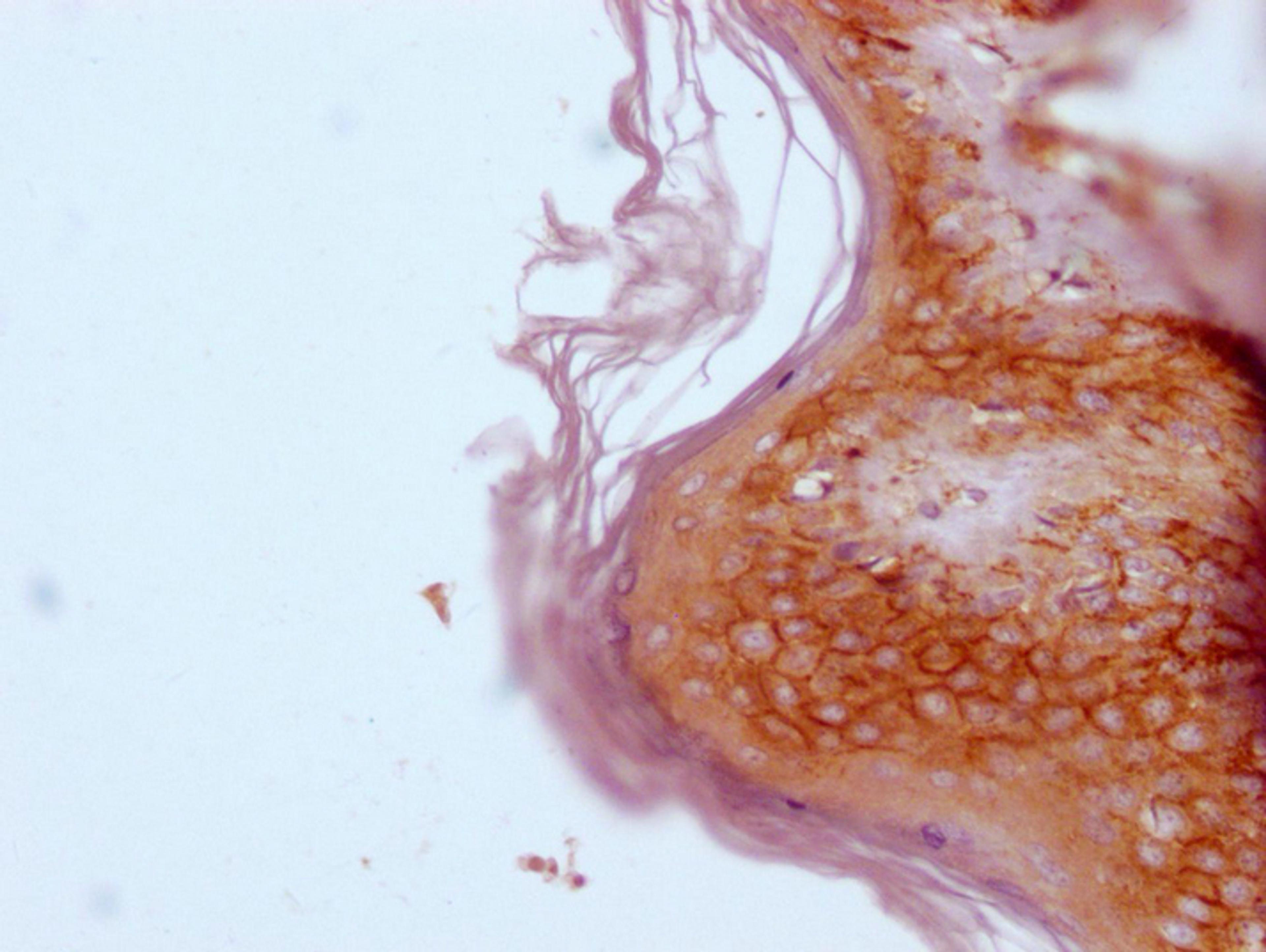 IHC image of CSB-MA247417 diluted at 1:100 and staining in paraffin-embedded human skin tissue performed on a Leica BondTM system. After dewaxing and hydration, antigen retrieval was mediated by high pressure in a citrate buffer (pH 6.0). Section was blocked with 10% normal goat serum 30min at RT. Then primary antibody (1% BSA) was incubated at 4°C overnight. The primary is detected by a Goat anti-mouse IgG polymer labeled by HRP and visualized using 0.05% DAB.