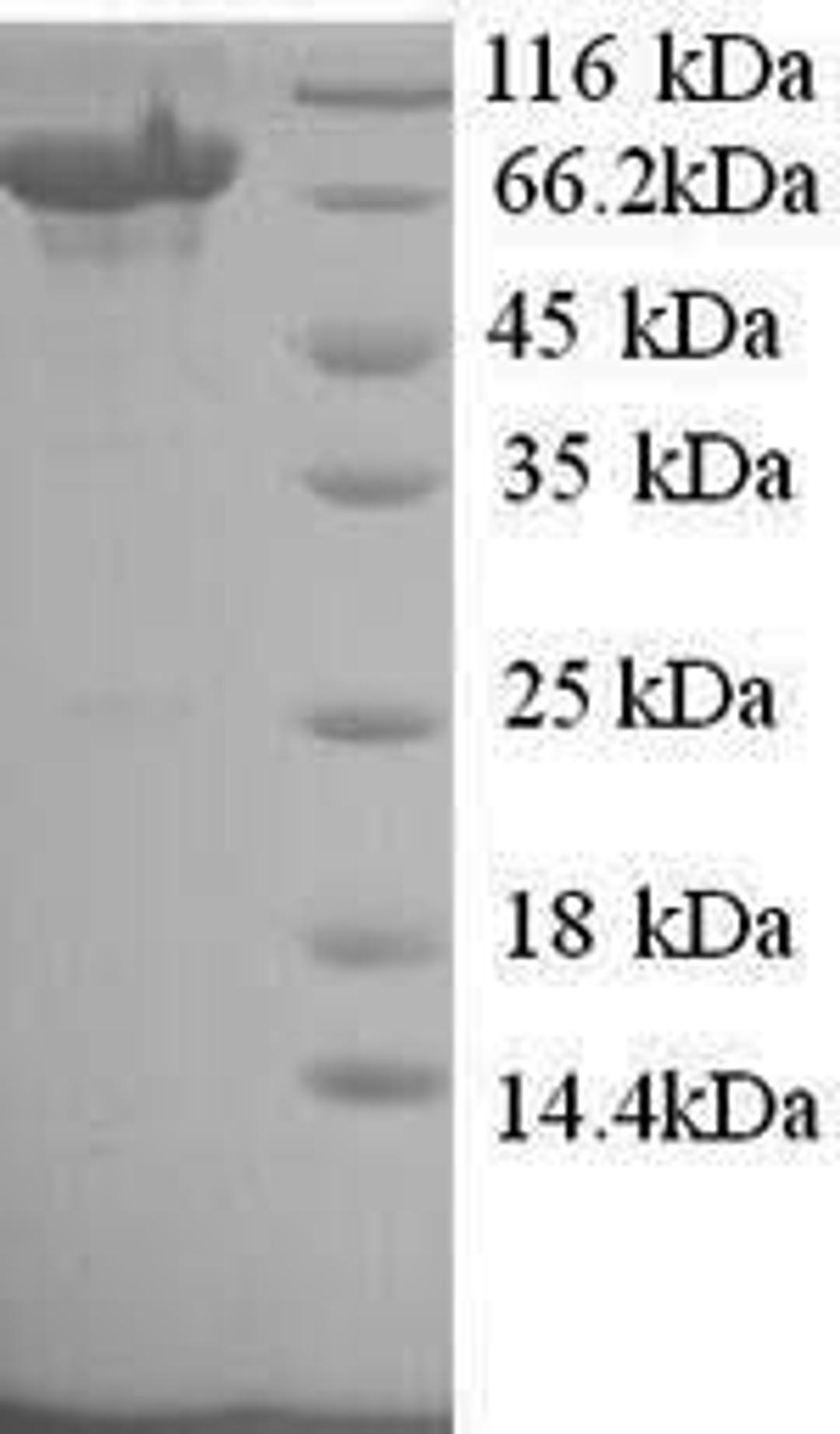 (Tris-Glycine gel) Discontinuous SDS-PAGE (reduced) with 5% enrichment gel and 15% separation gel.