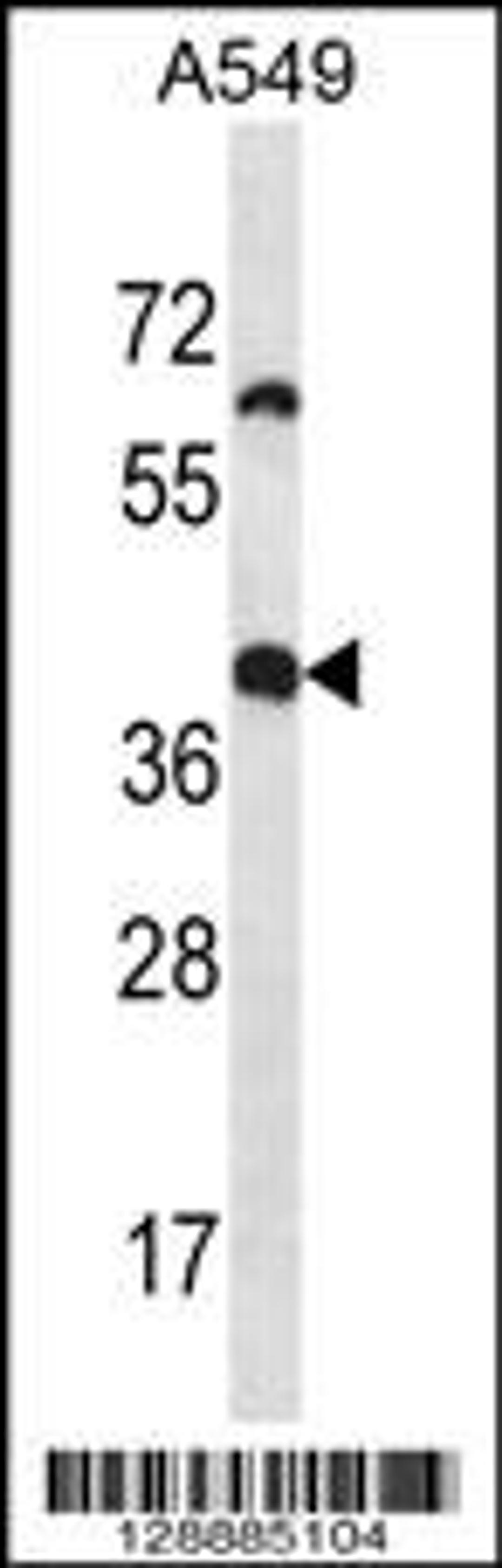 Western blot analysis in A549 cell line lysates (35ug/lane).