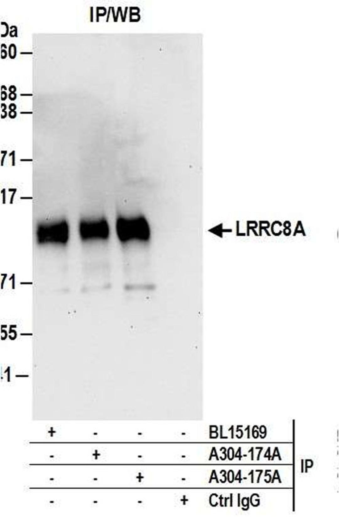 Detection of human LRRC8A by WB of IP.